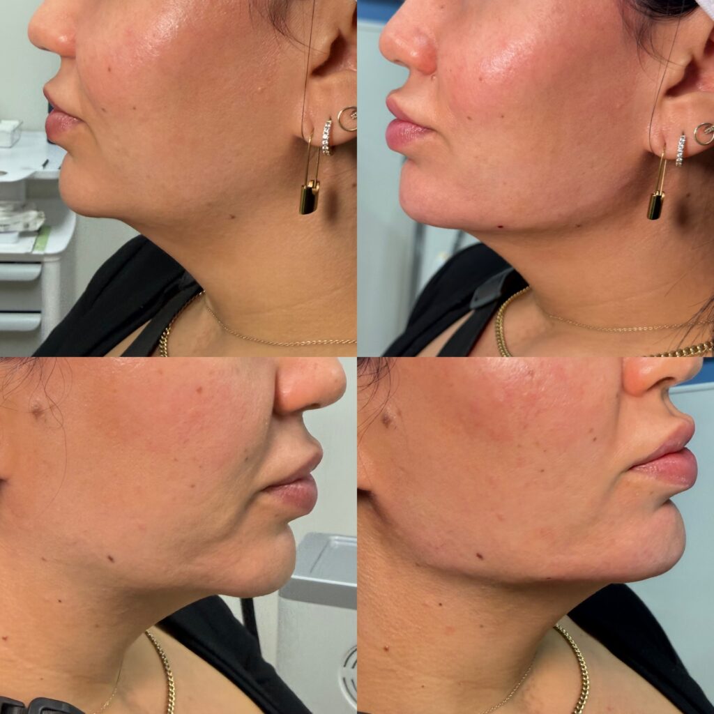 Why Eternia Medspa is the Go-To Destination for Aesthetic Enhancements